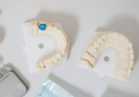 Aftercare Tips for Dental Implants